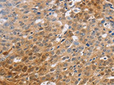 SLC16A7 Antibody