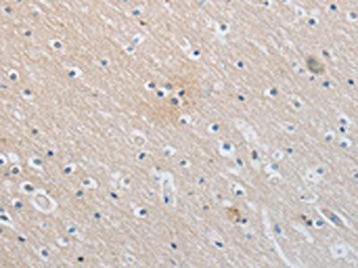 SLC16A7 Antibody