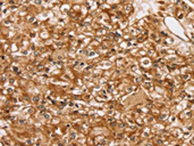 SLC16A8 antibody