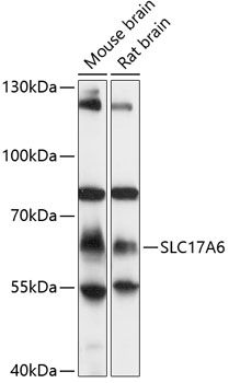 SLC17A6 antibody