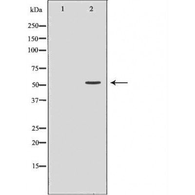 SLC18A2 antibody
