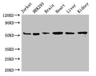 SLC18A2 Antibody
