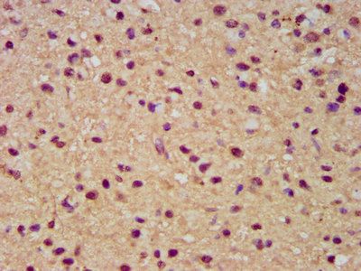 SLC19A2 Antibody