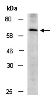 SLC19A3 (M1) Antibody, Rabbit Polyclonal