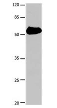 SLC1A1 Antibody