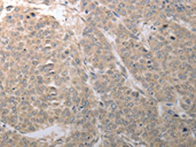 SLC1A4 Antibody