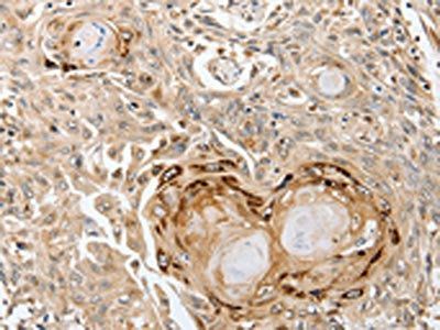 SLC1A7 Antibody
