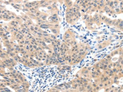 SLC20A1 Antibody