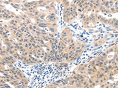 SLC20A1 antibody