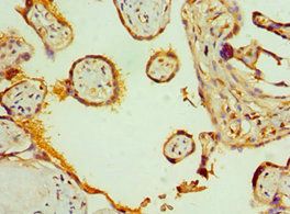 SLC20A2 Antibody