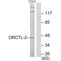 SLC22A18 Antibody