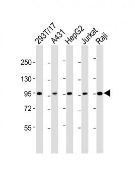 SLC22A2 antibody