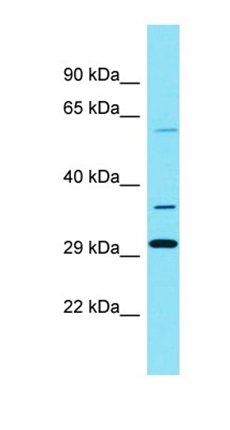 SLC22A25 antibody