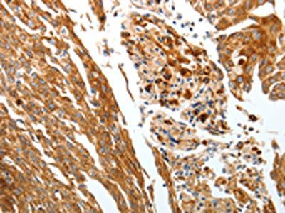 SLC22A3 Antibody