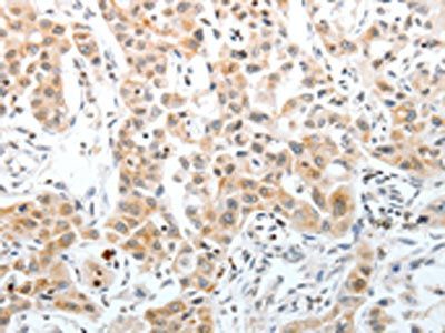 SLC22A3 Antibody