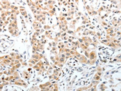 SLC22A3 antibody