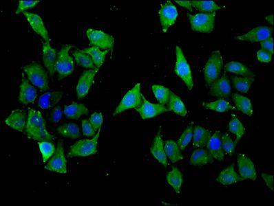 SLC22A5 Antibody