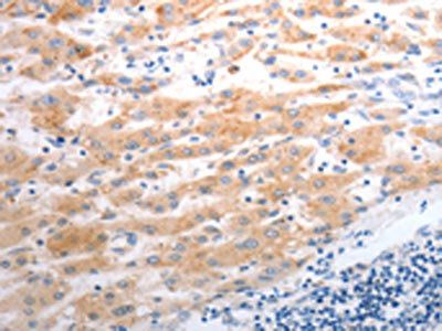 SLC22A6 Antibody