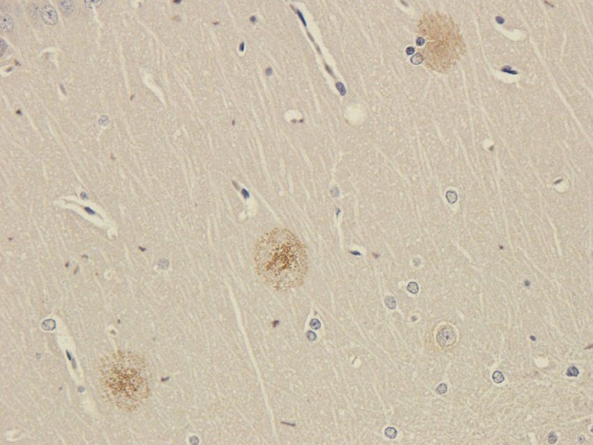 SLC22A6 Rabbit Polyclonal Antibody