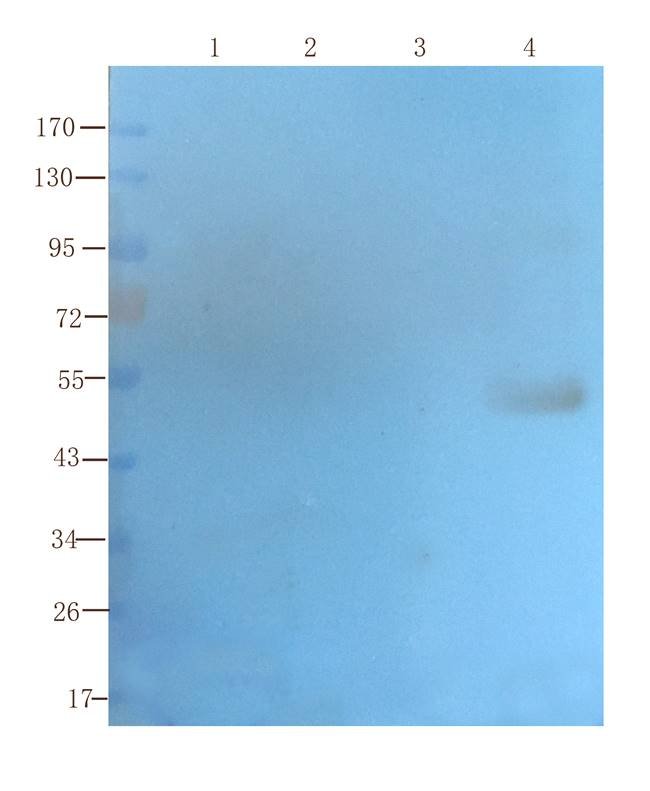 SLC22A8 antibody