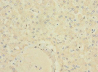 SLC22A9 Antibody
