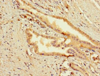 SLC25A10 Antibody