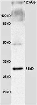 SLC25A10 antibody