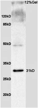 SLC25A10 Rabbit Polyclonal Antibody