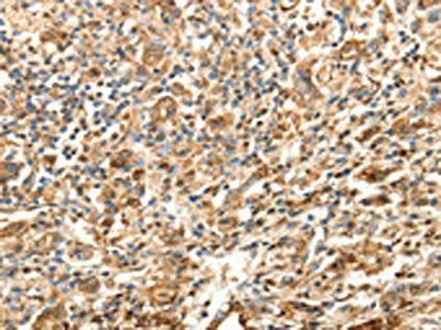 SLC25A11 Antibody