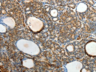 SLC25A11 Antibody