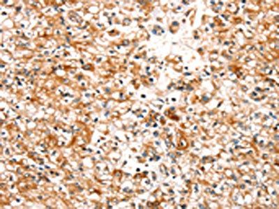 SLC25A12 antibody