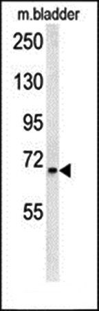 SLC25A12 antibody
