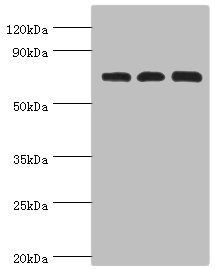 SLC25A13 antibody