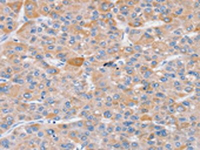 SLC25A13 antibody