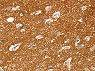 SLC25A13 antibody