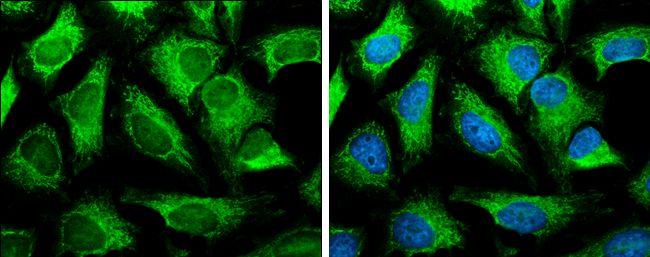 SLC25A13 antibody