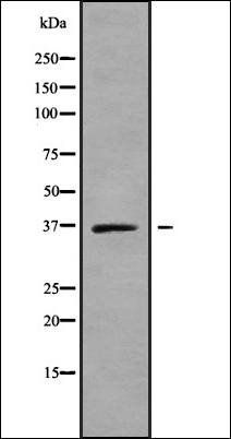 SLC25A14 antibody