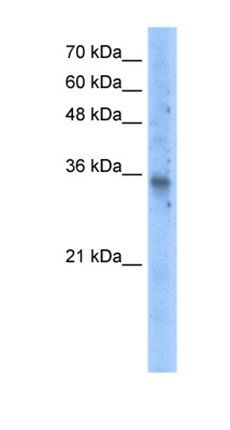 SLC25A16 antibody