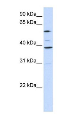 SLC25A16 antibody