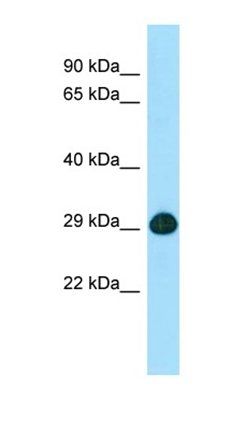 SLC25A2 antibody