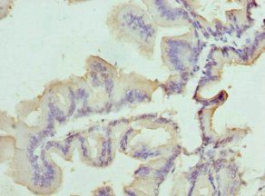 SLC25A20 Antibody