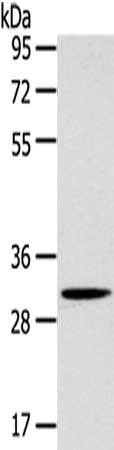 SLC25A20 antibody