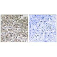 SLC25A21 Antibody