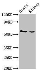 SLC25A23 Antibody