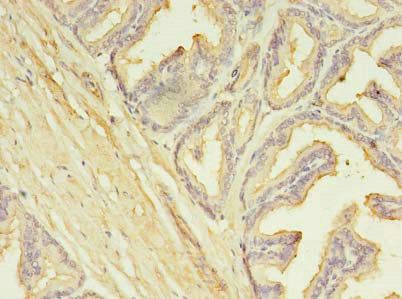 SLC25A25 Antibody