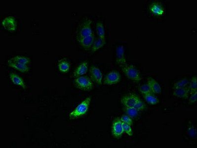 SLC25A33 Antibody