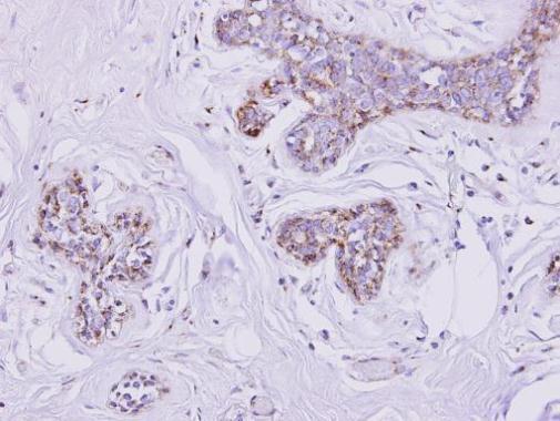 SLC25A33 antibody [N3C3]