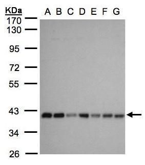SLC25A33 Rabbit Polyclonal Antibody