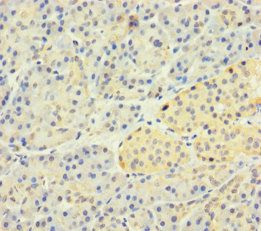 SLC25A35 Antibody
