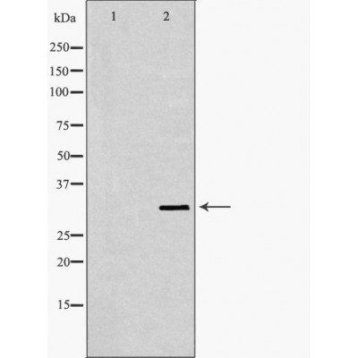SLC25A4 antibody